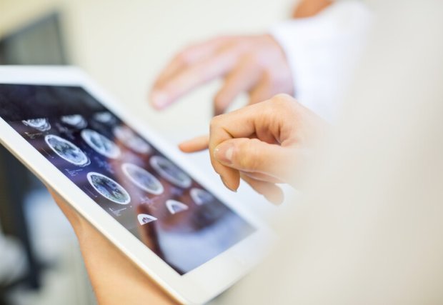 A doctor reviewing a brain scan